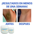 Crema Aclaradora Corporal