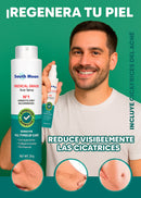 South Moon | Spray Elimina Cicatrices en semanas