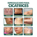 South Moon | Spray Elimina Cicatrices en semanas